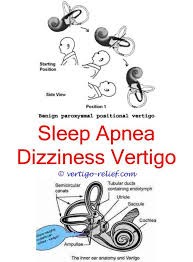 Benign Paroxysmal Vertigo Syndrome Tinnitus A Vertigo Sudden Vertigo And Hearing Loss Vertigo Relief 73090252 Vertigo Causes Vertigo Relief Vertigo Symptoms
