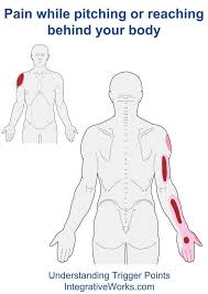 Pin On Frozen Shoulder
