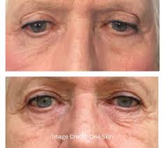 ONESKIN & SPA SKIN & BEAUTY