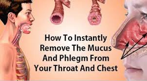 Coughing And Breathing Difficulties Are Often Caused By Nasal Or Throat Obstructions The Phlegm In The Lungs Getting Rid Of Mucus Getting Rid Of Phlegm Mucus