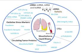 Health care professionals diagnose mesothelioma with a biopsy. Liquid Biopsy In Malignant Pleural Mesothelioma State Of The Art Pitfalls And Perspectives Semantic Scholar
