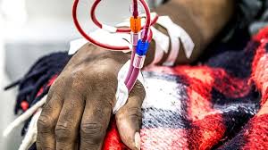 Image result for Dysequilibrium