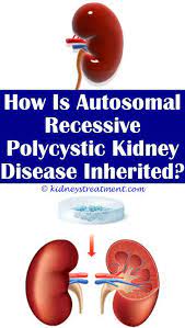 Kidney Function Improve Polycystic Kidney Disease Kidney Disease Stages Kidney Disease