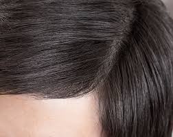 Hair loss, also called alopecia, is a side effect of cancer treatments, such as chemotherapy and radiation therapy. Lung Cancer Immunotherapy Darkens Patients Hair