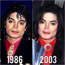 He couldn't help that he had vitiligo. Some people are cruel. 🤦🏼‍♀️