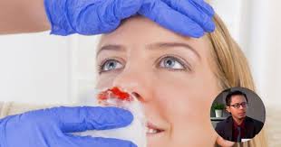 Tangan mbak farah mulai mengocok penisku sementara tangan yang satunya mengelus dadaku sementara itu dia membiarkan kedua payudaranya aku mainkan malah dengan tangannya dia. Begini Cara Pantas Kena Buat Bila Hidung Berdarah Alert 10 Tip Mudah Doktor Ini Keluarga