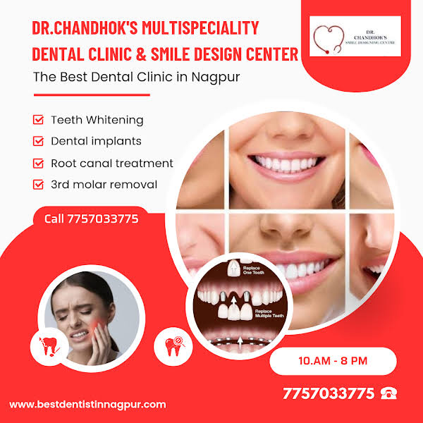 Root canal treatment (RCT) in Nagpur product image