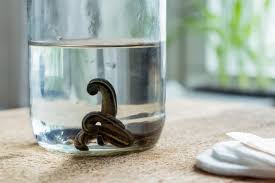 Terapia cu lipitori imbunatateste circulatie sangelui, de aceea este recomandata si persoanelor care au probleme cu pierderea podoabei capilare. Hirudoterapia Terapia Cu Lipitori Una Dintre Cele Mai Benefice Metode Complementare De Tratament