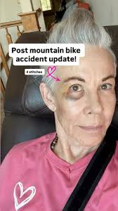 🚴‍♀️ My Type 2 daughter, @annetuttlebrown asked: “Are you discouraged?”  🙅‍♀️ Nope—just a bump in the road! Mountain biking means falls happen. I  stay strong so I can bounce back. 📊 30%