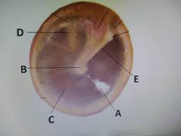 This page is not even relevant to holistic health in the form it is now. Physical Examination And Health Assessment Diagram Quizlet