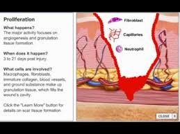 Stages Of Wound Healing Process