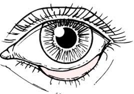 What does tro stand for? Physiological Ectropion Definition Of Physiological Ectropion By Medical Dictionary