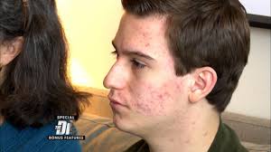 Teen with Mysterious Severe Pain Returns