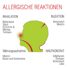 So würden auch die dämpfe zurück gehalten und der milben staub sowieso. Allergie Fur Teppich Gibt Es Nicht Teppichboden Aw Associated Weavers
