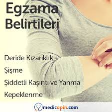 Egzama Daha Cok Genetik Ve Psikolojik Nedenlerle Ortaya Cikan Yaygin Bir Deri Hastaligidir Rahatsizligin Erken Teshisi Tedavinin Basa T Shirt Women Allbirds