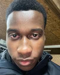 yearly post birthday dump