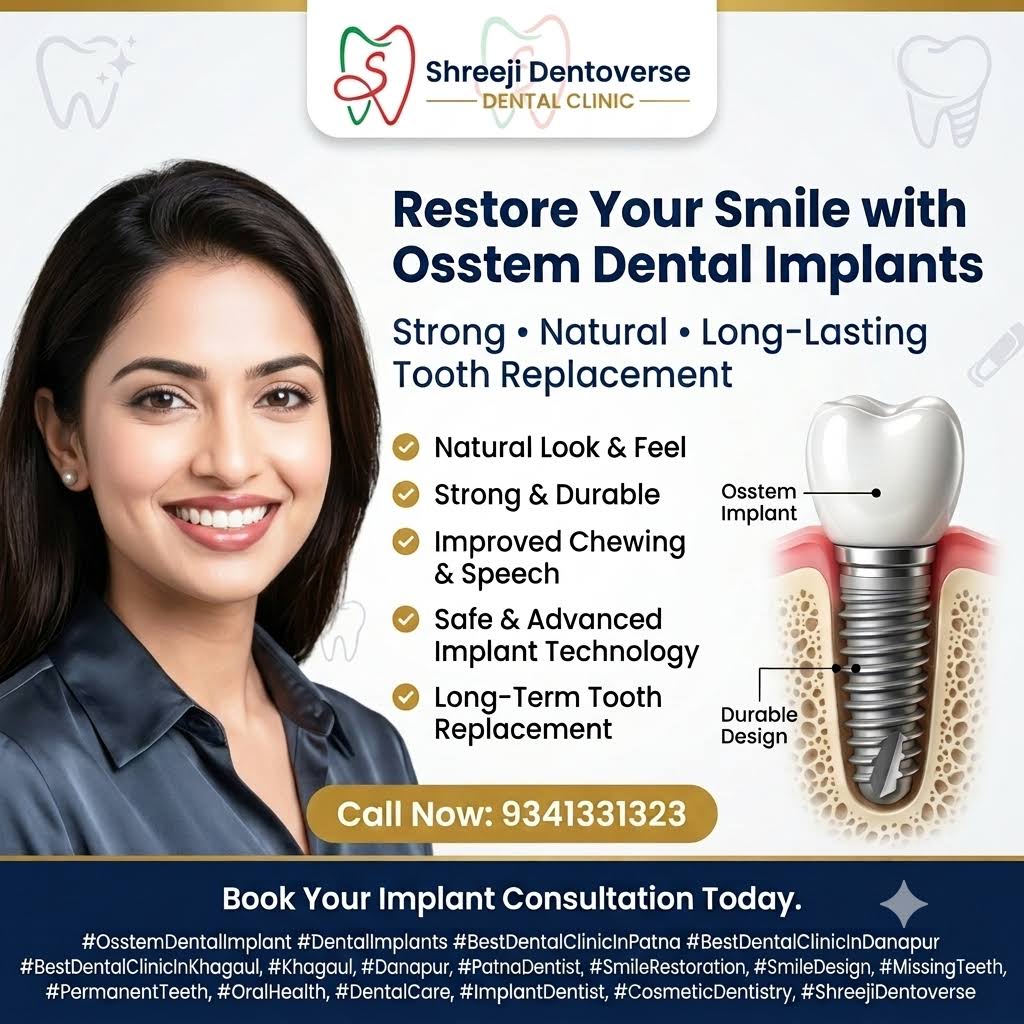 Dental implant product image