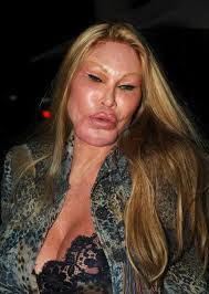 Now she's relatively famous for what looks like a little too much plastic . Jocelyn Wildenstein Cat Lady Plastic Surgery Rich Women Celebs