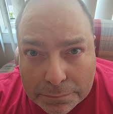 Why is there a separate volume knob for the radio alarm?