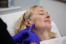 Top Tips For How to Tighten Saggy or Loose Skin