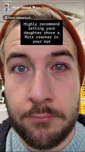 Thats gotta hurt, hope Ryan Recovers quick : r/RyanGeorge