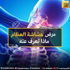 مرض هشاشة العظام ماذا تعرف عنه هشاشة العظام هو مرض عظمي غالبا ما يكون صامتا يتميز بنقص كثافة وقوة العظام مما يزيد من وقوع الكسور ه movie posters movies poster