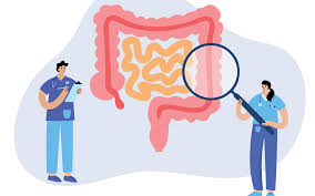 Most medical organizations recommend starting screening around age 50, or earlier if you have risk factors for colorectal cancer. At Home Colorectal Cancer Screening What You Should Know Cedars Sinai