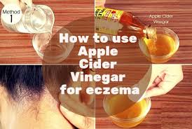 Organic apple cider vinegar, organic aloe vera juice, coconut oil, shea butter, sunflower oil, rice bran oil, neem oil, vegetable. Apple Cider Vinegar For Eczema How To Use It Guide