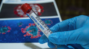 28.11.2021 · la doctora angelique coetzee le explicó a la bbc cómo se dio cuenta en su consulta que estaba ante una nueva variante del coronavirus y dijo que los síntomas que han visto en sudáfrica hasta. El Grupo De Trabajo Covid 19 Declaro Sintomas De Personas Expuestas A La Variante Leve De