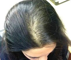 маска для роста волос в домашних условиях с перцем Eti Tri Ingredienta Ostanovyat Vypadenie Volos I Vosstanovyat Ih Silu I Blesk Za 1 Vypadenie Volos U Zhenshin Domashnie Sredstva Dlya Volos Pricheski Dlya Tonkih Volos