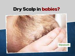 Wet the cloth and wring it out, then gently wipe your baby's hair. Dry Scalp In Babies Symptoms Causes And Ways To Treat At Home