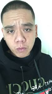 Post-transplant weed use and potential denial