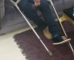 صور حفرة تكسر رجل حسن الرداد إرم نيوز