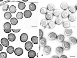 Image result for Berkheya bipinnatifida