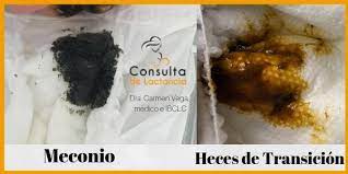 Va De Cacas Como Son Las Heces Normales Del Bebe Consulta Lactancia Sevilla