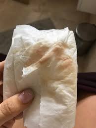 Ectopic pregnancy usually occurs in contact your doctor immediately if you have pink brown bleeding and its getting more intensive. Brown Spotting 12 Weeks Pregnant 12 Qcpy