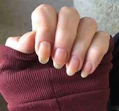 This Is The Longest My Nails Have Ever Been Nearly Four Months Of Growth From Extreme Nubs It S All Because Of This Community And The Inspiration I Ve Gotten From People Here Even And most importantly for anyone whose acrylics are starting to grow out and can't acrylic nails are artificial nail extensions made of acrylic plastic, placed over your natural nails.