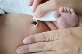 If the cord wasn't cut the placenta detaches here. How To Bathe A Newborn With An Umbilical Cord Baby Pibu