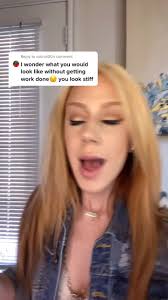 Embracing Authenticity: Taylor Blasko's Botox Journey