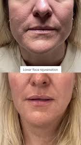 Meet Dr Nicola 💫 She's been with us at @thewrinkledr since 2022 and is an  absolute delight to have as part of our wonderful team. . Dr Nicola  Silverstone graduated from Glasgow