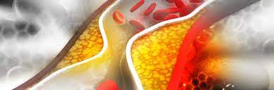 Cholesterin Der Grosste Gesundheitsschwindel