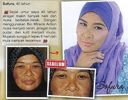 Deep penetrating skin repair and revitalization. Naz Jomshopping Blogspot Com Bio Miracle Action Terbukti Berkesan Menghilangkan Jerawat Jeragat Kulit Kusam Parut Dan Kedutan