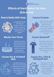 It may be tempting to save time and only half dry hair before bed, but this is a terrible mistake. Effects Of Hard Water On Skin Hair Hard Water Eczema