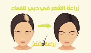 زراعة الشعر في دبي للنساء الشعر هو تاج النساء وتساقط الشعر يسبب الكثير من المشاكل النفسية والكثير من المشاكل الأخ Ways To Grow Hair Grow Hair Back Hair Control