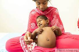 Liver Disease Symptoms Types Causes And Treatments And Financial Support Milaap