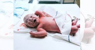Penelitian menyebutkan, makan buah sebelum tidur adalah waktu terburuk. Jangan Main Main Kes Bayi Tertelan Najis Dalam Kandungan Ada Kesan Buruk Kepada Bayi Pa Ma