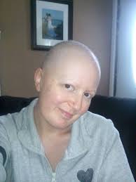 Ladies, I have breast cancer and have therefore lost my hair. But it  doesn't change anything about this person, I wanted to say that we all have  to be friendly to each