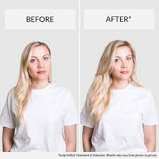 .are dealing with thinning hair and hair loss: Fine Hair Here S The Products You Need For Fine Thin Hair 2021 Hairlust Uk