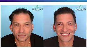Panel of Discussion with Renowned Hair Loss Expert Dr. Alan Bauman