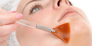 Chemisches peeling chemisches peeling behandelt von dr. Chemische Peelings Wie Gefahrlich Ist Das Pharmazeutische Mittel